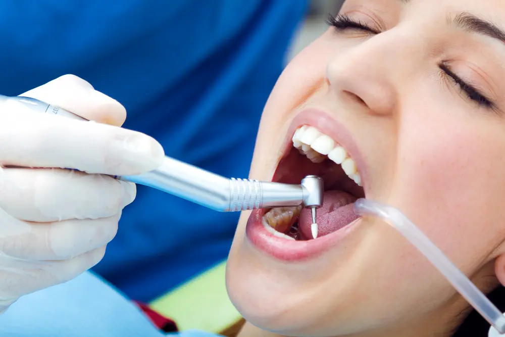 Teeth Cleaning and Scaling