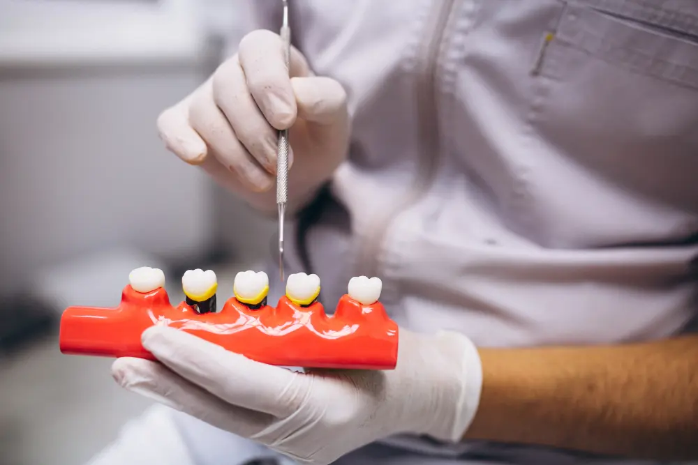 Root Canal Treatment