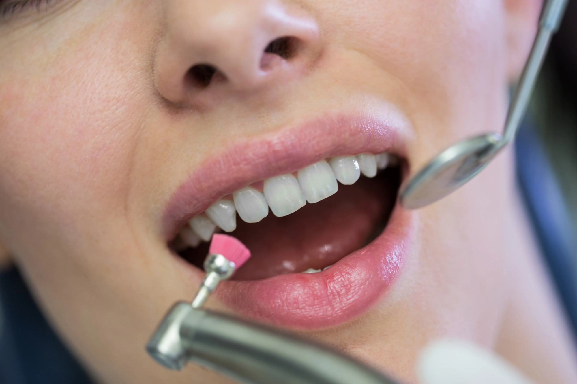 dentist-examining-female-patient-with-tools